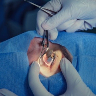 Oftalmología General (Operación)